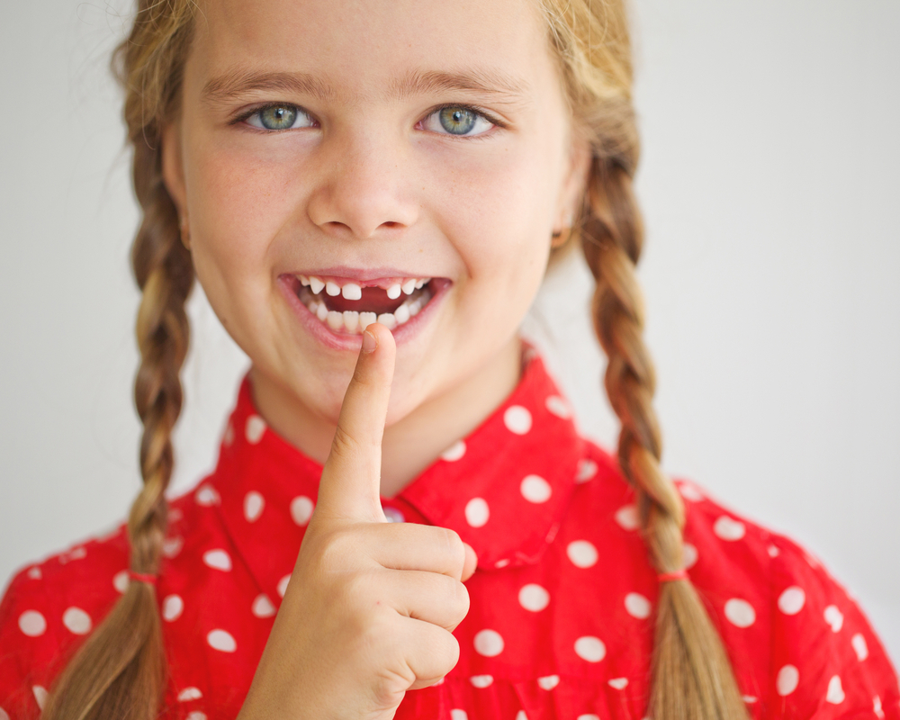 dientes de leche