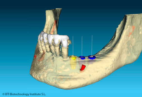 tecnología dental en Getxo