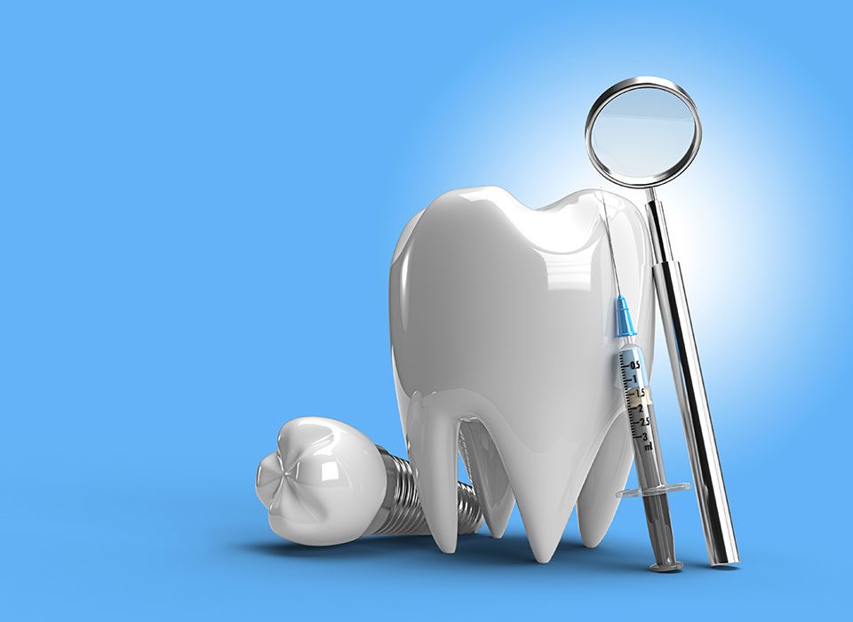 tipos de implantes dentales